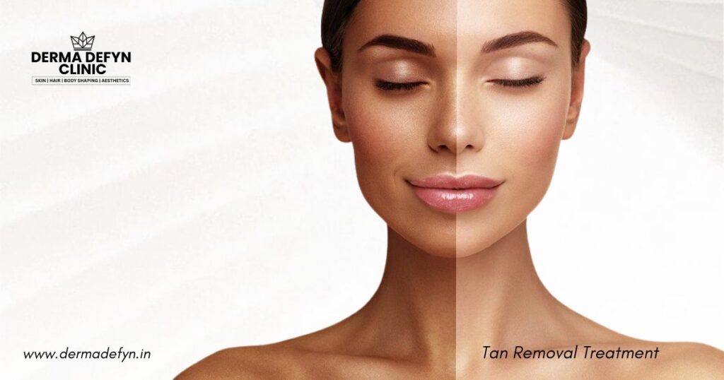 How to do tanning removal for face