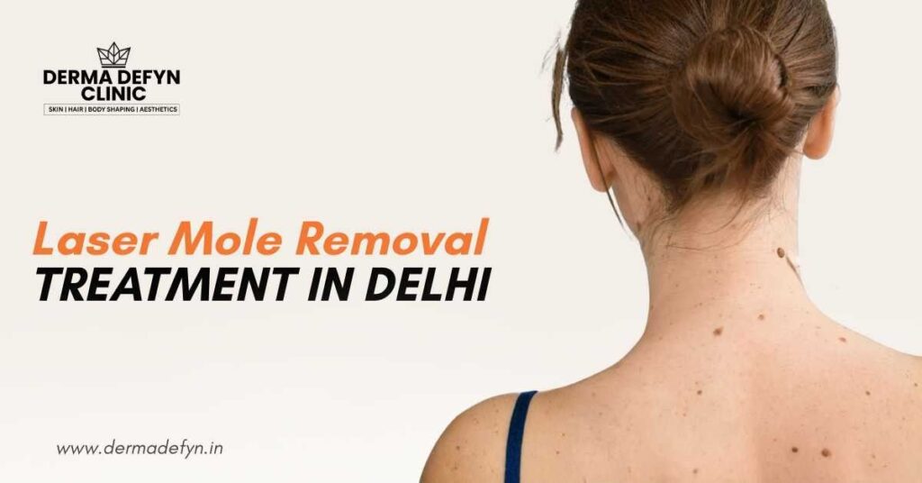 The #1 Laser Mole Removal Treatment You Need to Know