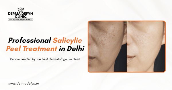 Professional Salicylic Peel Treatment in Delhi