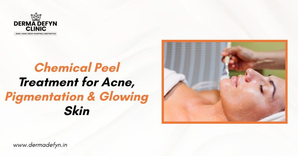 Chemical Peel Treatments for Acne, Pigmentation & Glowing Skin
